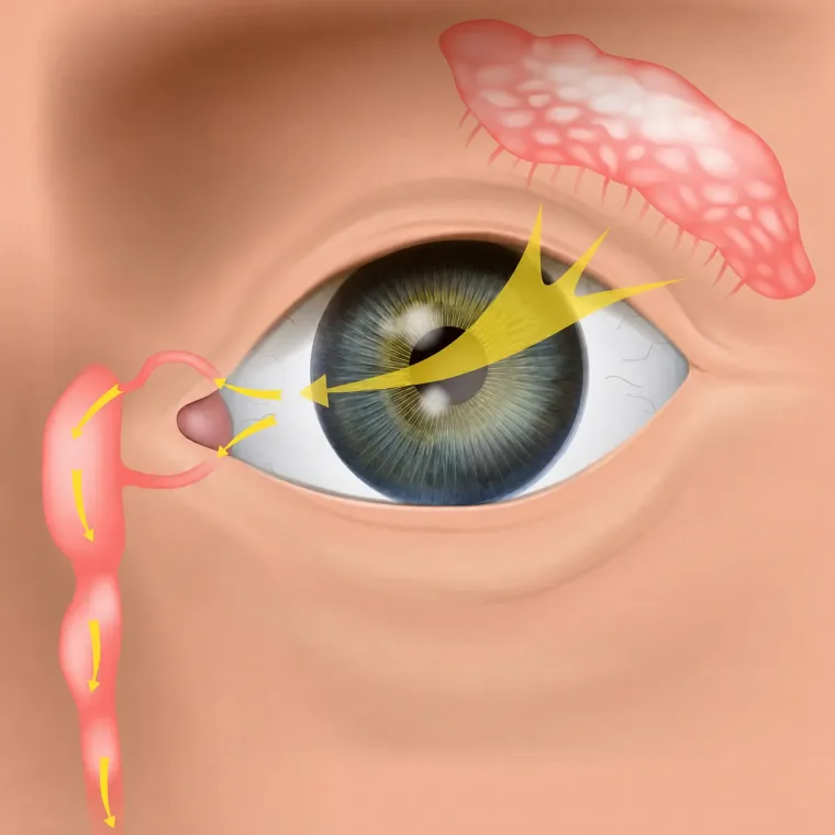 Ilustração anatômica do sistema lacrimal: a glândula produz a lágrima, que escoa do canto do olho até o nariz pelo canal lacrimal
